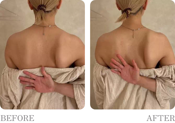 ビフォアーアフター3