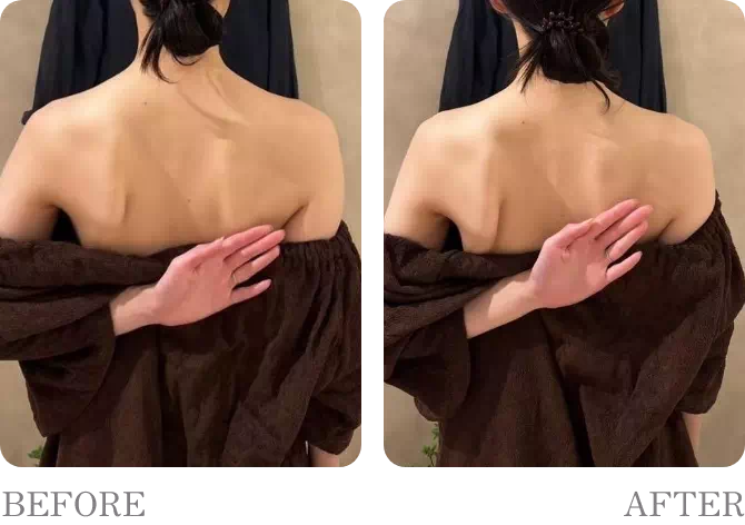 ビフォアーアフター4