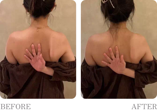 ビフォアーアフター5