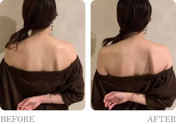 ビフォアーアフター6