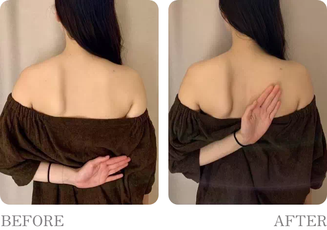 ビフォアーアフター8