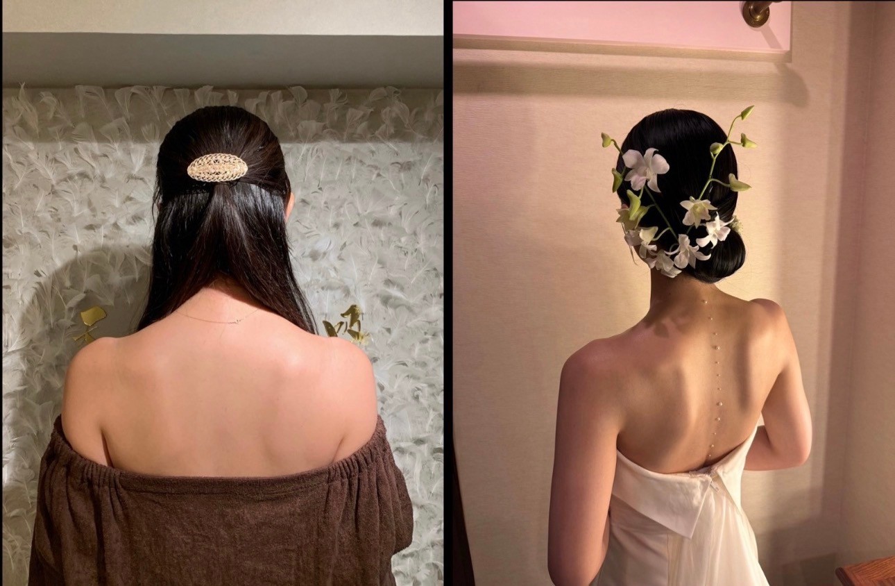 ビフォーアフター1